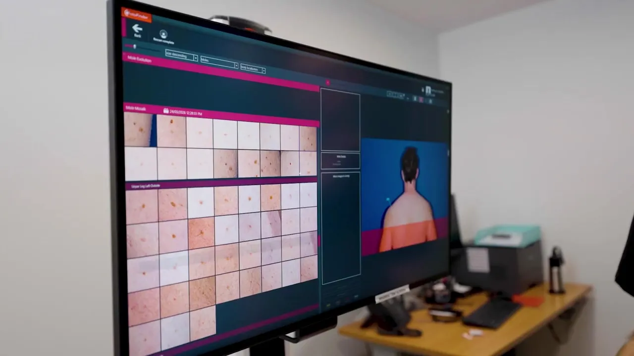 The FotoFinder mosaic view showing every mole from a total body scan side by side